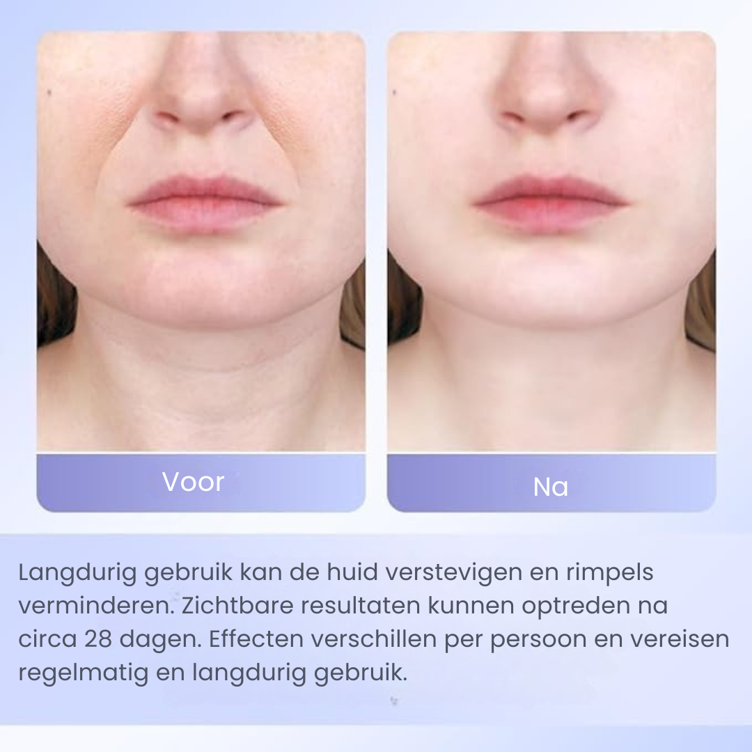 Lumilift skin - voor Gezicht & Hals met LED en EMS
