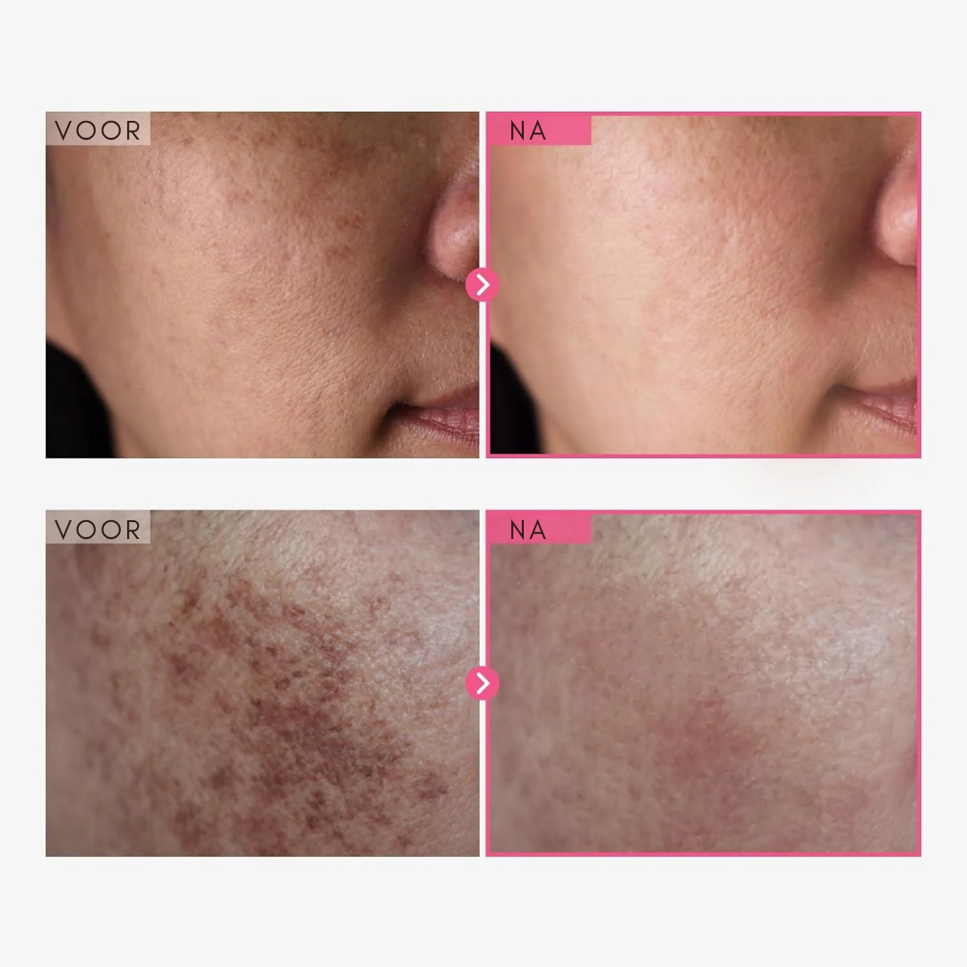 BrightRepair Pigment Correctie Crème