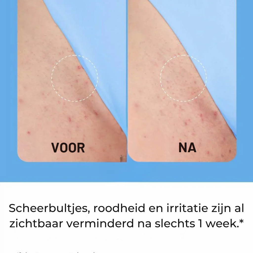 Smoothing Solution Ingrown Hair Treatment