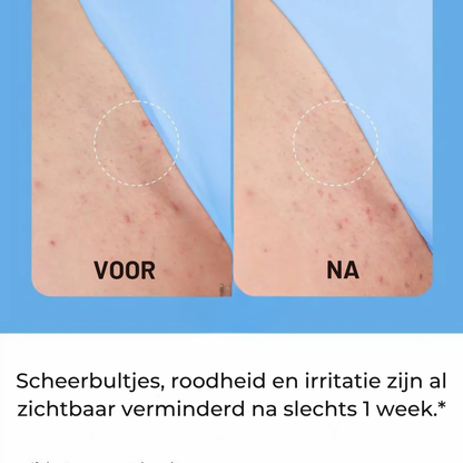 Smoothing Solution Ingrown Hair Treatment