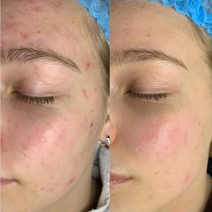 BrightRepair Pigment Correctie Crème