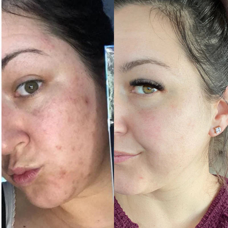 BrightRepair Pigment Correctie Crème